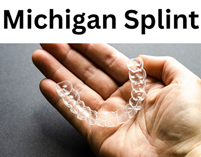 Michigan Splint: A Comprehensive Guide