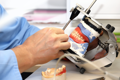 The Essential Role of a Dental Lab Technician
