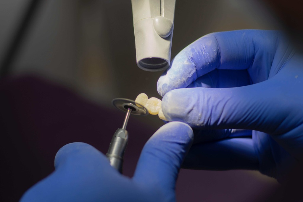 The Essential Role of a Dental Lab Technician