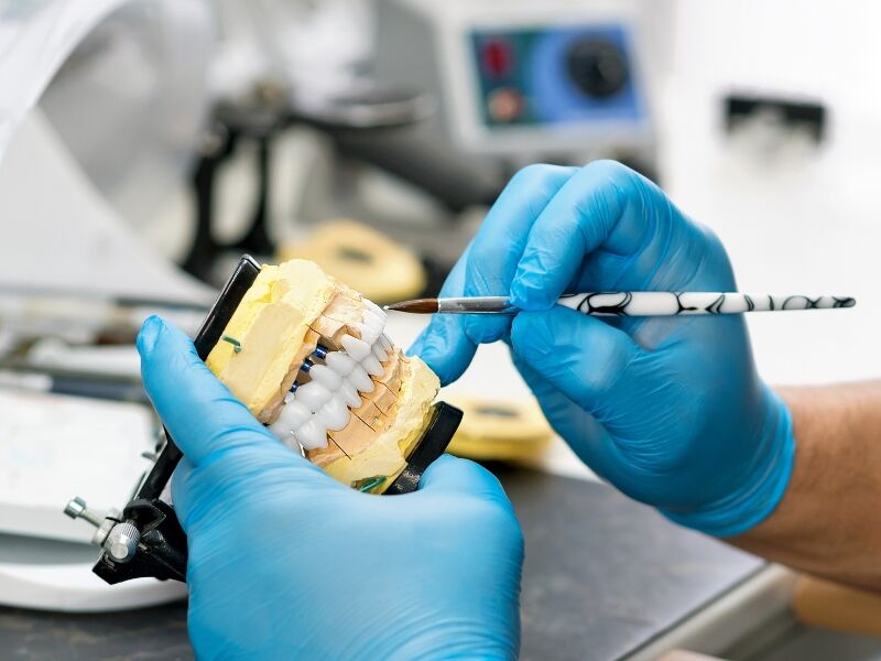 Dental Laboratory Services: A Detailed Overview